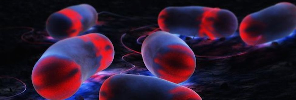 legionella monitoring