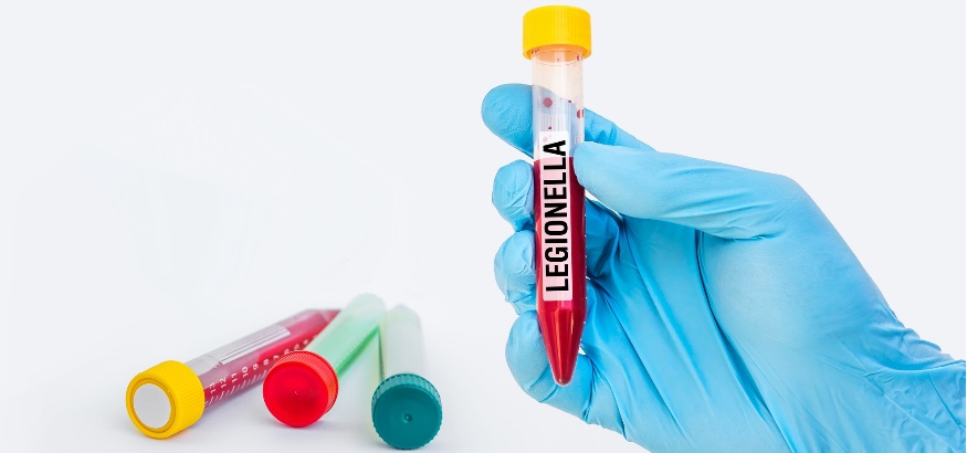 legionella-risk-assessment