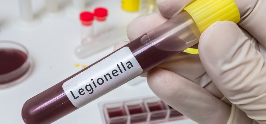 legionella