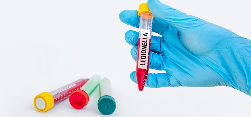testing-for-legionella